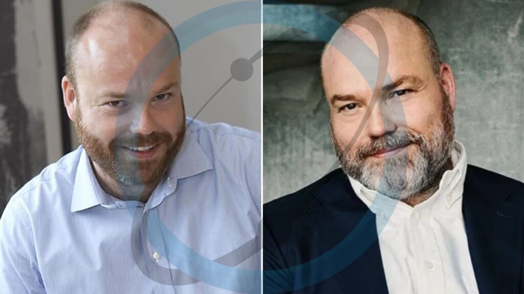 Anders Holch Povlsen: The Billionaire Fashion Mogul Transforming Retail and Rewilding Scotland anders holch povlsen